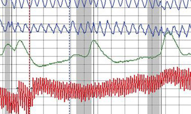 polygraph chart on a reality tv show